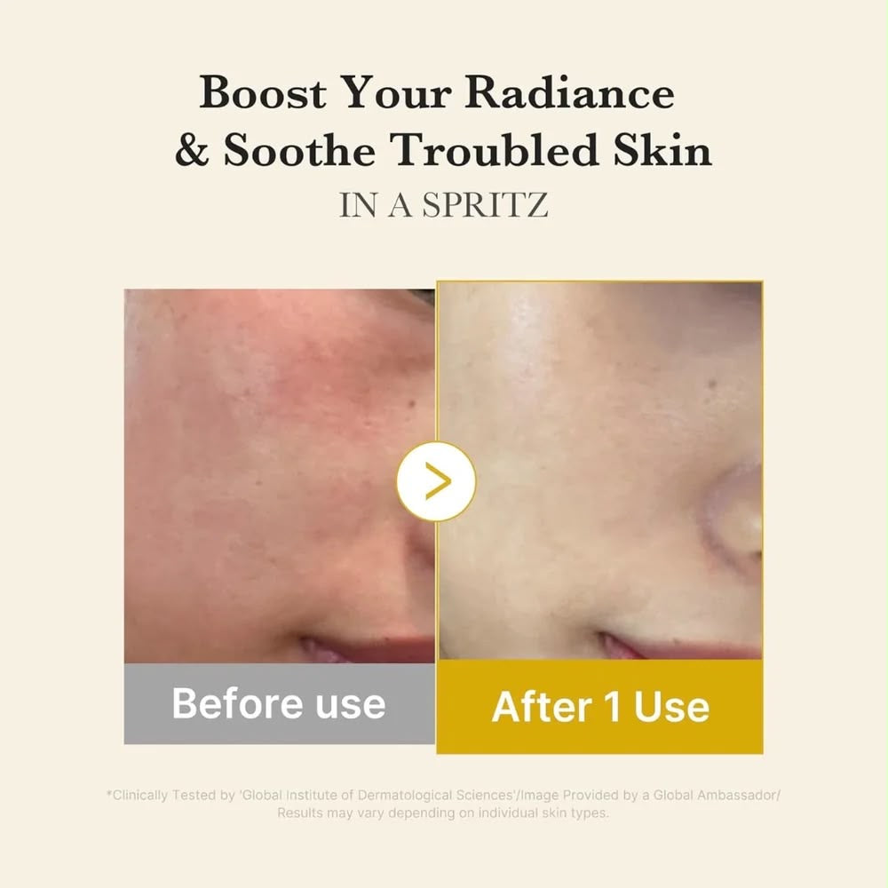 KOJIC ACID TURMERIC VITA JELLY MIST SERUM