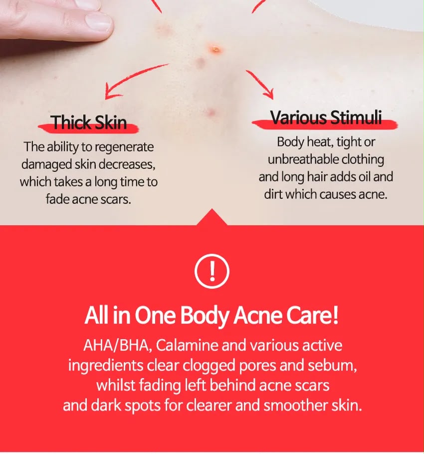 ANTI BLEMISH BODY LOTION