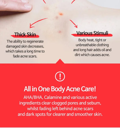 ANTI BLEMISH BODY LOTION