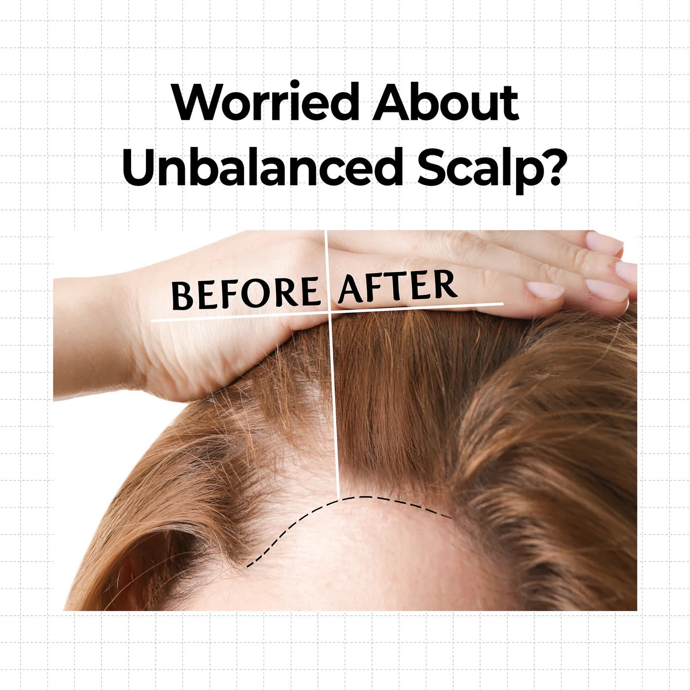 10X CAFFEINE STRENGTHENING SCALP SERUM