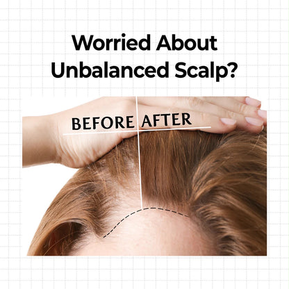 10X CAFFEINE STRENGTHENING SCALP SERUM