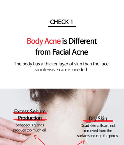 ANTI BLEMISH BODY LOTION