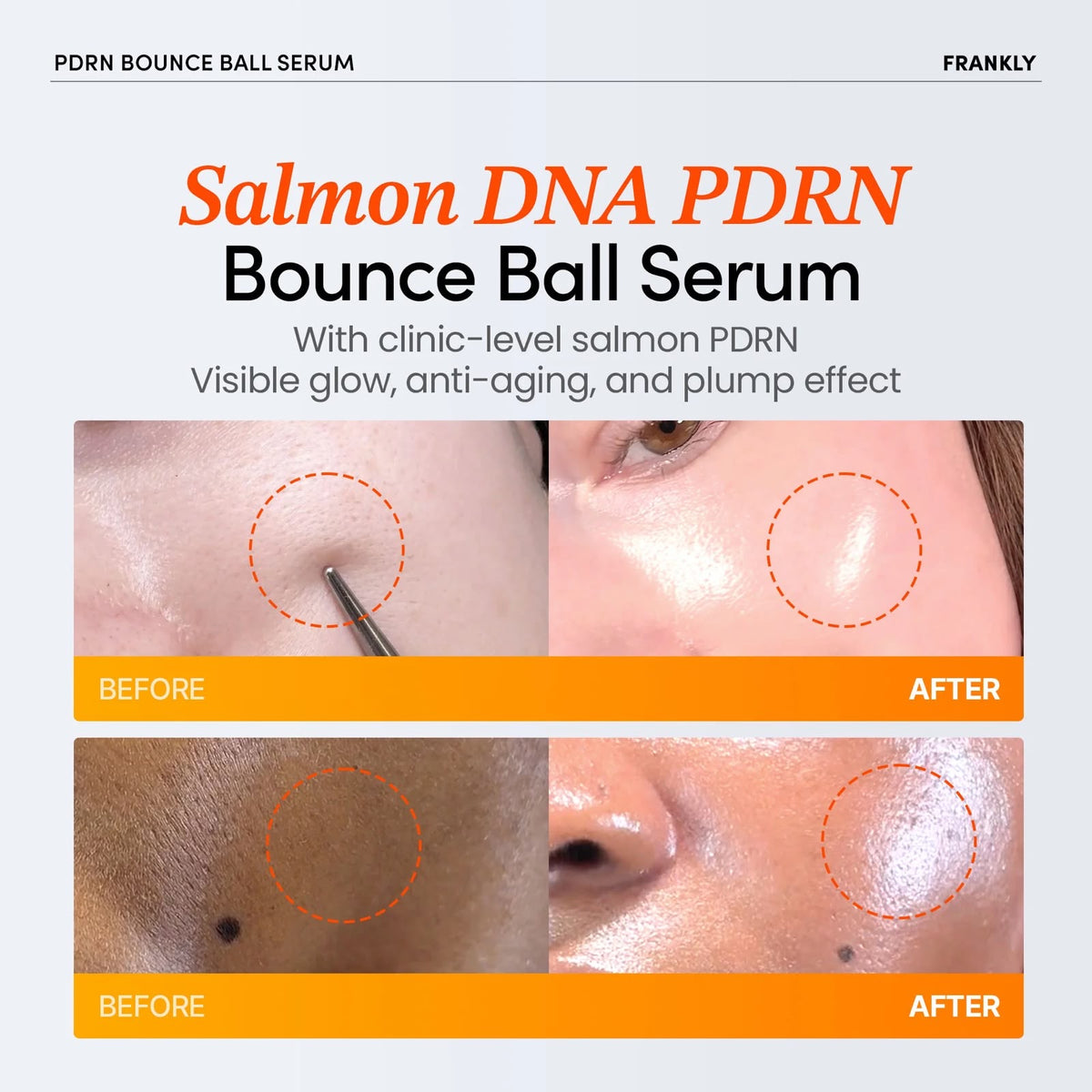 SALMON PDRN BOUNCE BALL SERUM