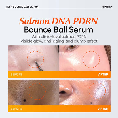 SALMON PDRN BOUNCE BALL SERUM
