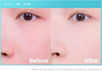 PEPTIDE PORE TENSION MASK
