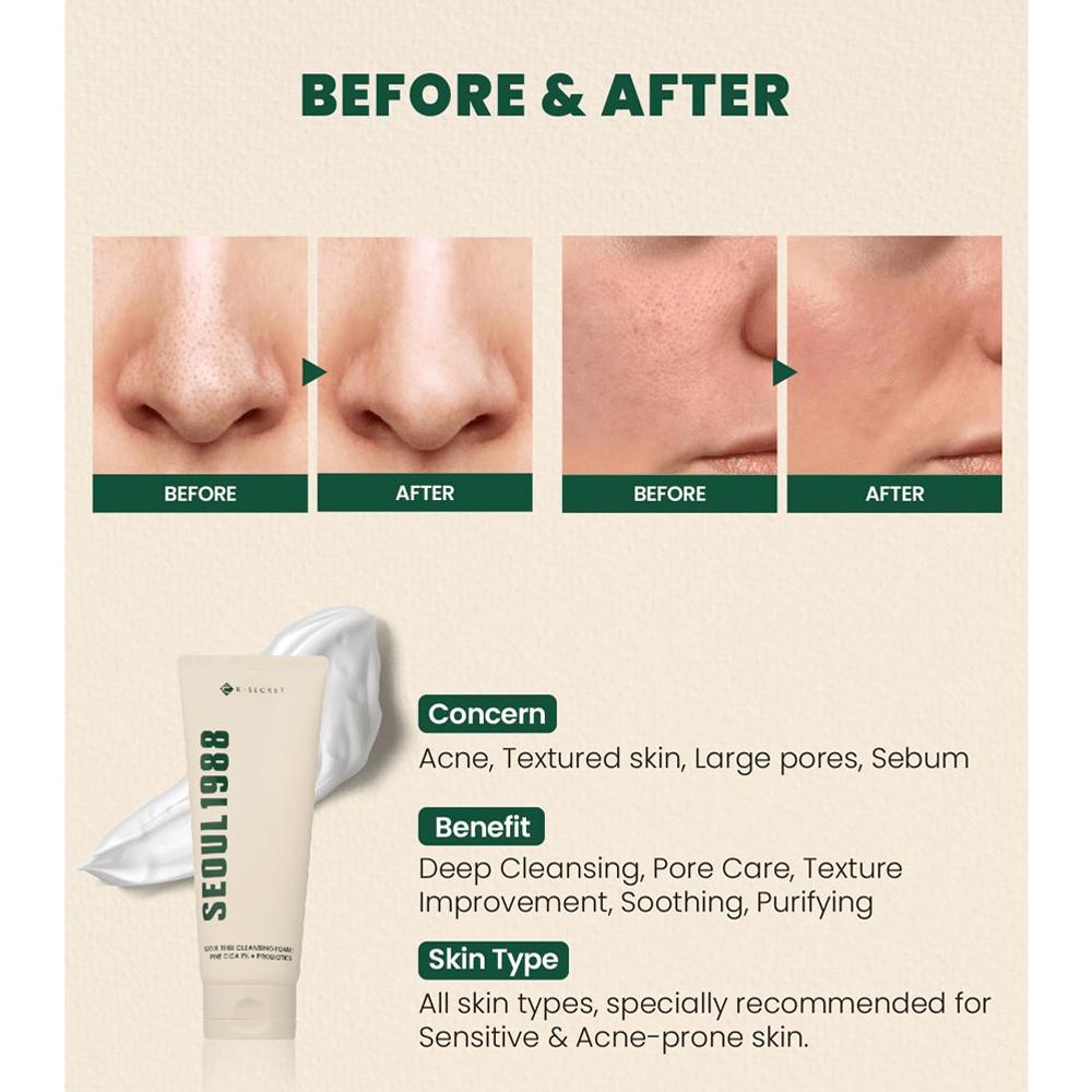 SEOUL 1988 Cleansing Foam : Pine Cica 1% + Probiotics