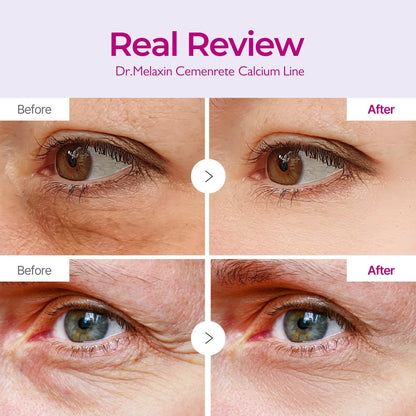 CALCIUM VOLUME EYE PATCH